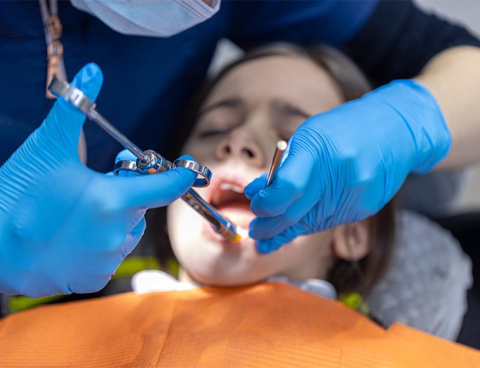 Does Wisdom Tooth Extraction Affect Eyesight?