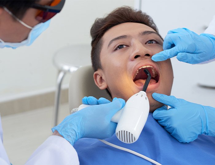 Single Sitting Root Canal Treatment