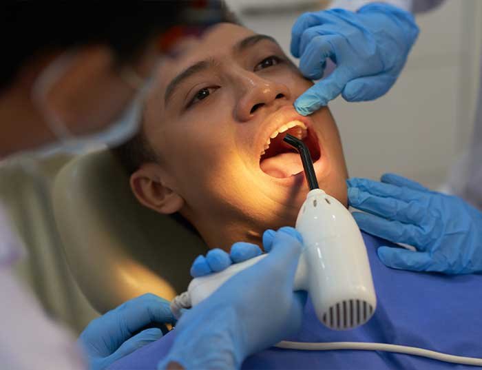 Is Single Sitting Root Canal Treatment Right for You?