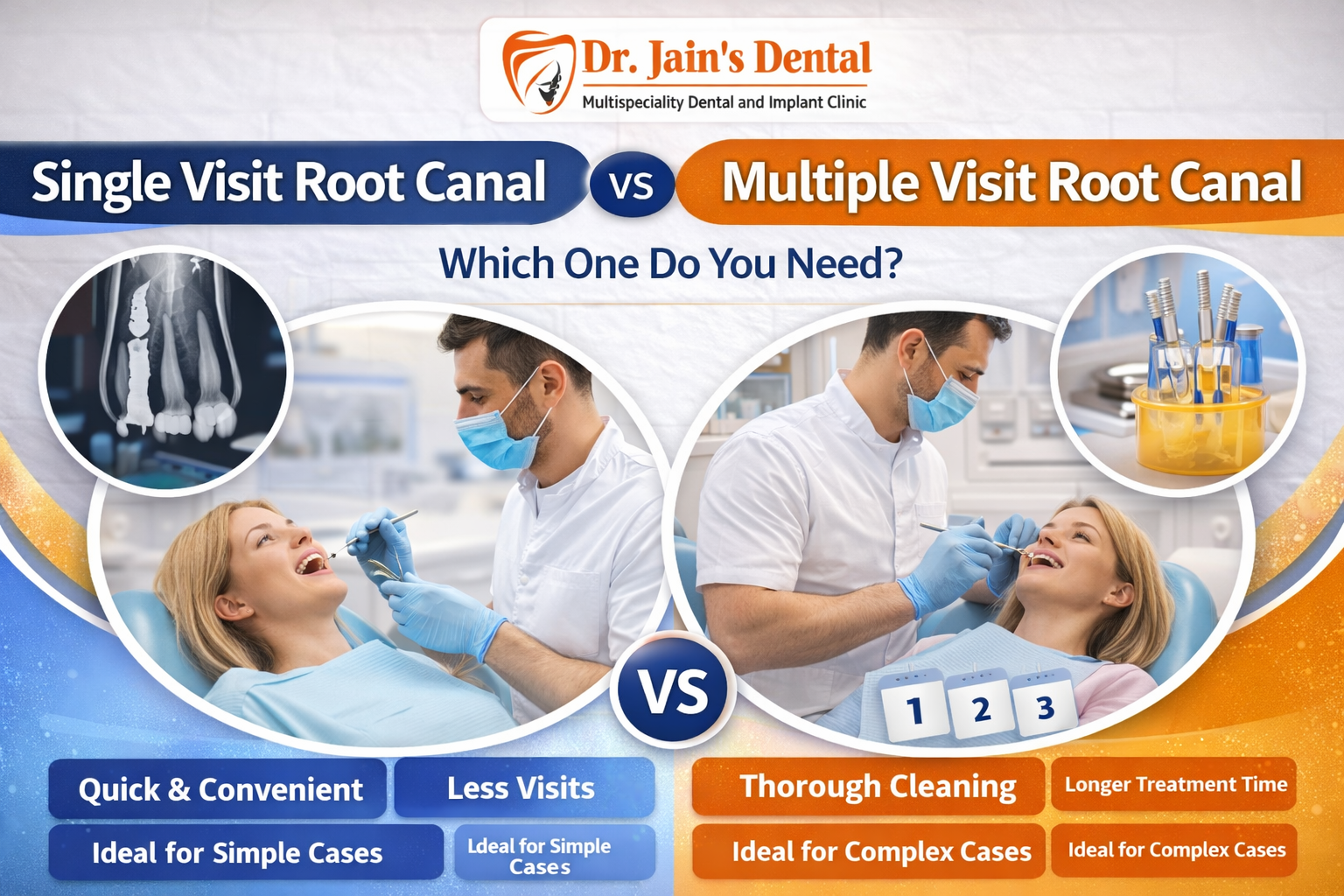 Single vs Multiple Visit Root Canal: Which One is Better? | Dr Jain's ...