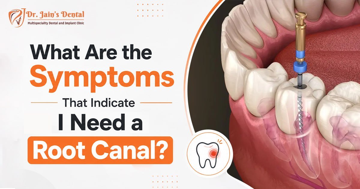 What Are the Symptoms That Indicate I Need a Root Canal?