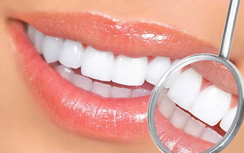 Instant Teeth Whitening